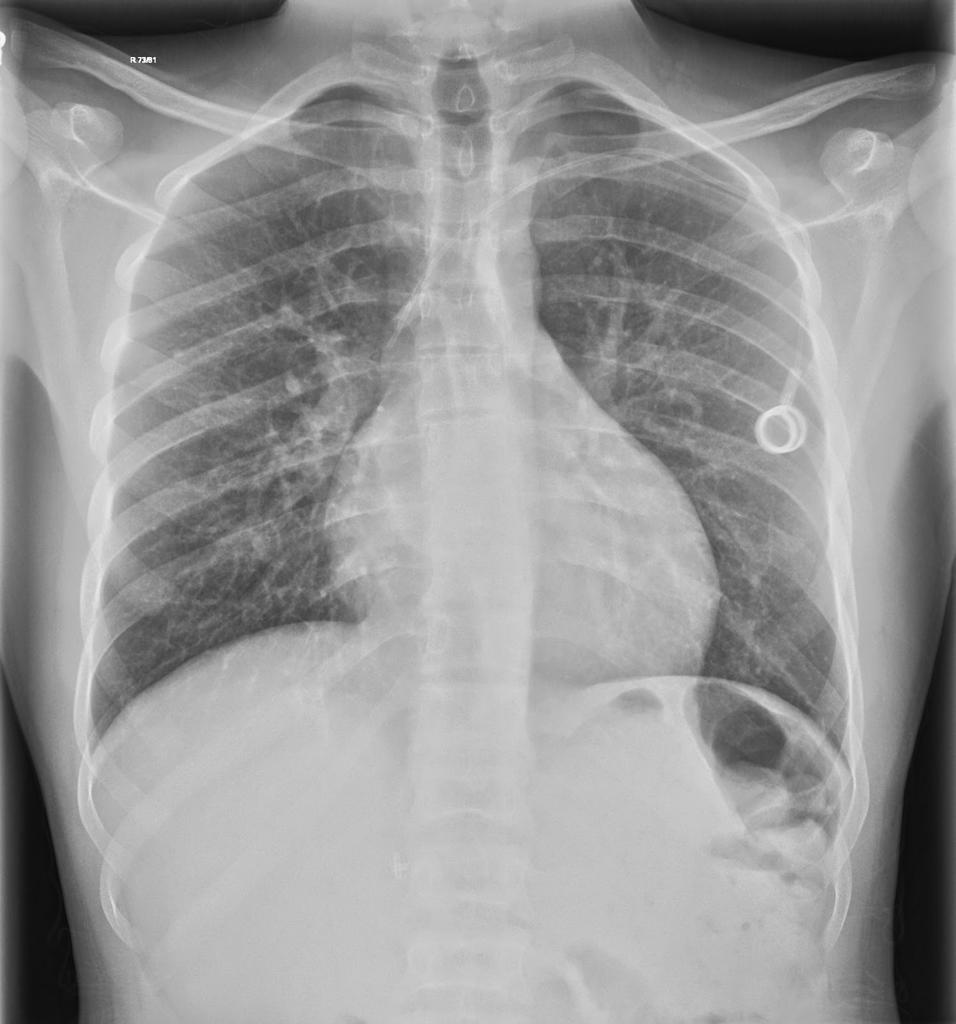 معاینات و تست های قلب و عکس پرتوی ایکس از سینه