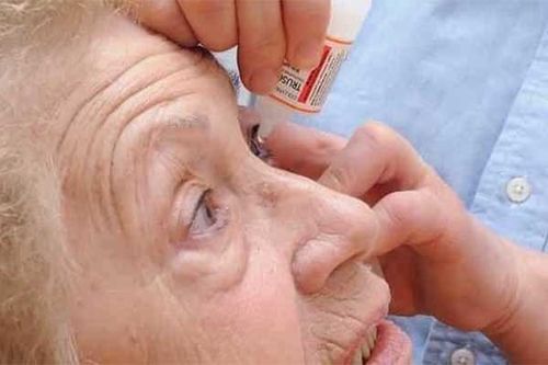 مصرف قطره چشم و دارو بعد از عمل آب سیاه طبق تجویز پزشک لازم است.