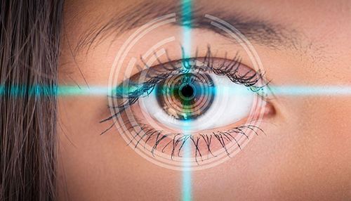 عمل لیزیک چشم، برای درمان دوربینی، نزدیک بینی و آستیگمات صورت می گیرد.