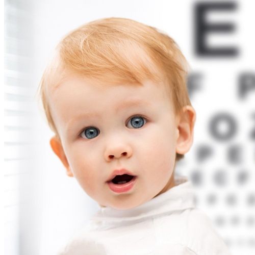 تنبلی چشم در کودکان شایع است.