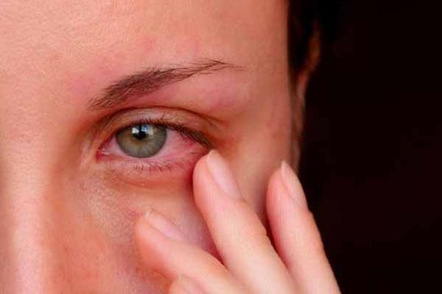 عفونت چشم دلایل مختلفی دارد و از بیماری های شایع چشم است.