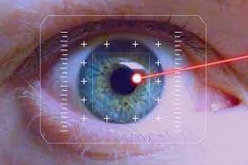 مزایای عمل آستیگمات چشم با لیزیک چیست