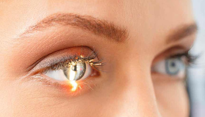عمل لازک چشم به دلیل مزایای بی‌شماری که دارد، محبوبیت زیادی بین افراد پیدا کرده است.