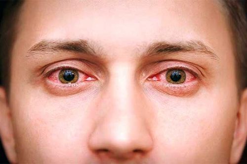 شناخت انواع قطره‌های چشمی، موضوعی مهم است.