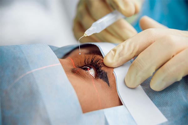 در جراحی آب مروارید با لیزر، چشم‌ها به‌طور هم‌زمان عمل نمی‌شوند.