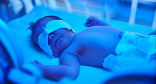 اگر زردی نوزاد شما تشخیص داده شده است، باید بدانید که این یک بیماری شایع و معمولاً خفیف است که به راحتی قابل درمان است. 