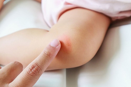 عفونت ساق پا کودکان، علل متفاوتی دارد.