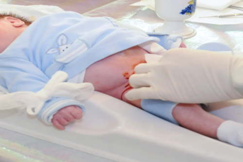 تصویر نوزادی در حین ختنه نمایش داده شده است.