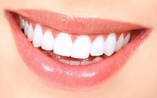 انواع راه های سفید کردن دندان و عوارض